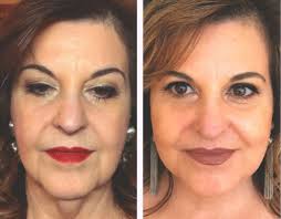 Antes e depois do Revera Vit modelo 2